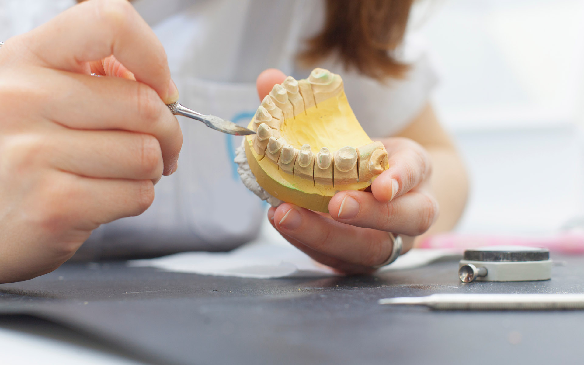 Tehnici noi, care schimbă felul în care realizăm protezele dentare. De ce este extrem de importantă pregătirea danturii